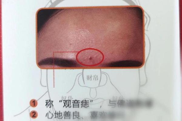 菩萨的痣在哪里 观音痣誉为福气面相