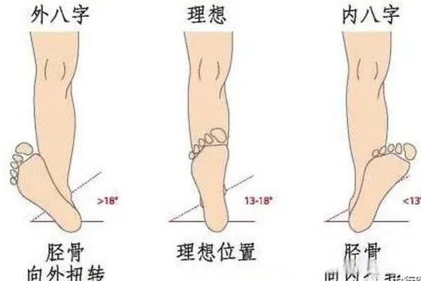 内八字和外八字