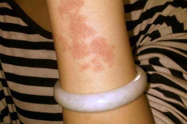 如何通过自己的胎记算命看自己的一生-