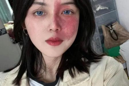 看脸上胎记如何算命