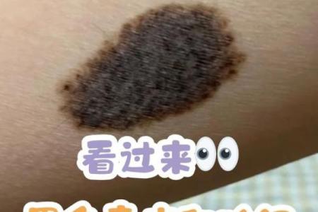 身体上的胎记位置不同算命分析