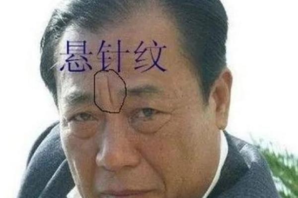 男人印堂八字纹的命运