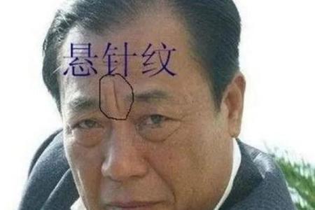 男人印堂八字纹的命运