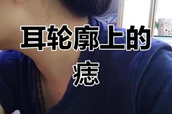 风水上耳朵有痣的人命运