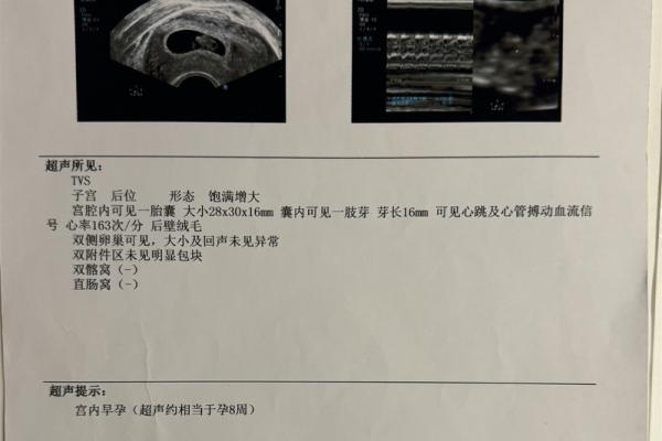 算命说打过胎实际没有胎心