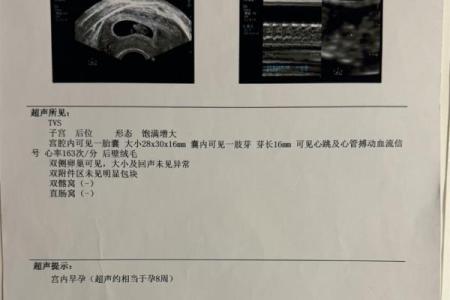算命说打过胎实际没有胎心