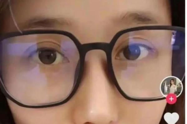 眼睛黑眼珠子多算命