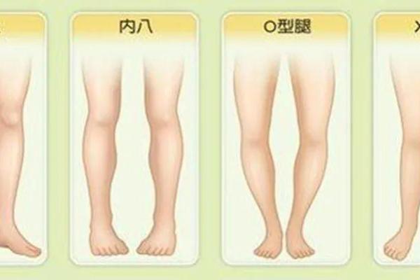 内八字外八字
