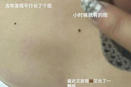 胸部痣相图解算命