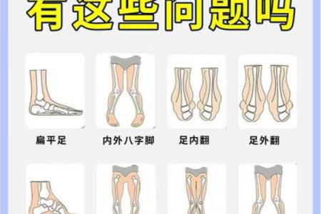 婴儿八字腿