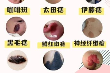 根据背部胎记算命