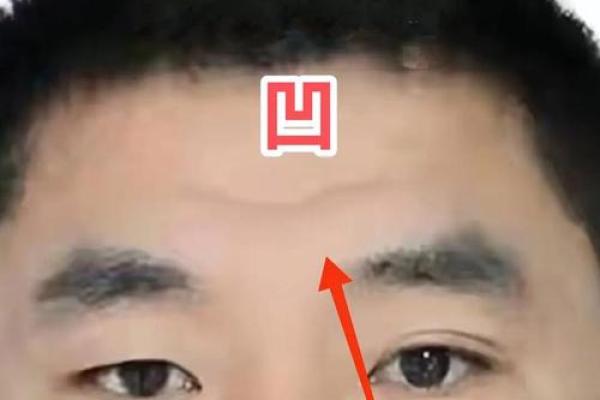 胎记算命介绍 胎记算命介绍