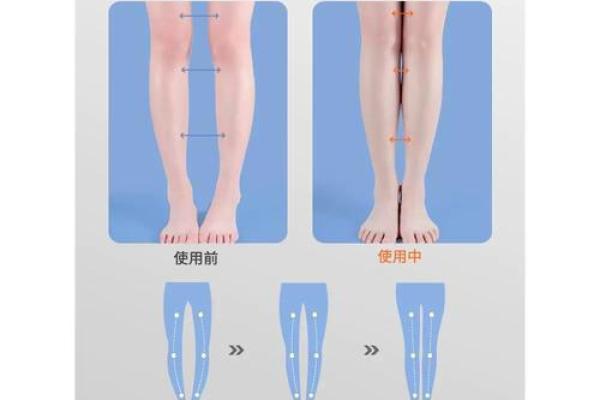 小腿内八字 小腿内八字