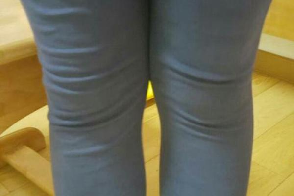 小腿内八字 小腿内八字