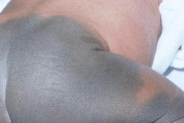 古算命，比较有福气的10处胎记