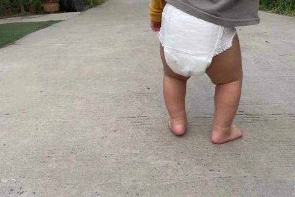 内八字腿型 内八字腿型