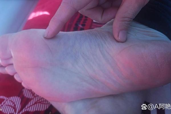 八字纹的女人是穷相吗？