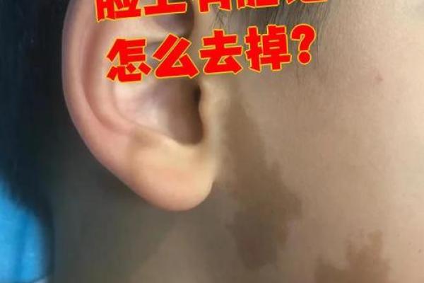 额头上的胎记算命