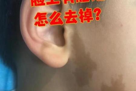 额头上的胎记算命