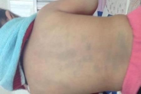 全面解析：胎记算命图解