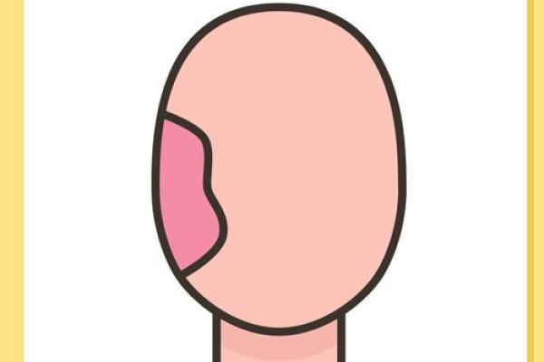 胎记算命大全 胎记算命大全