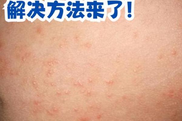 屁股有白斑风水