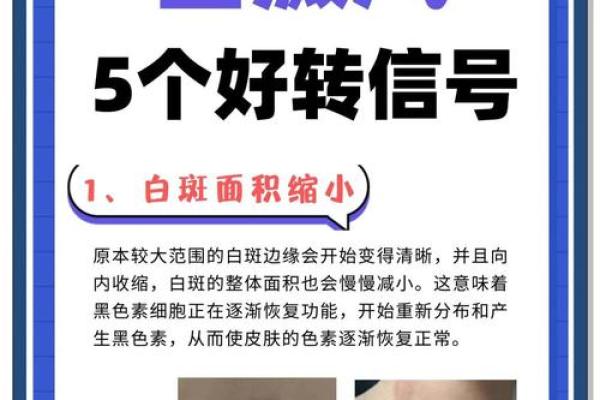 屁股有白斑风水