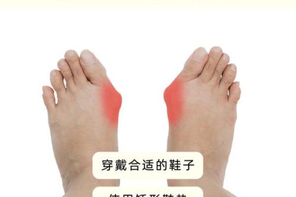 足脊健康知识小课堂（第三期） -  外八字篇